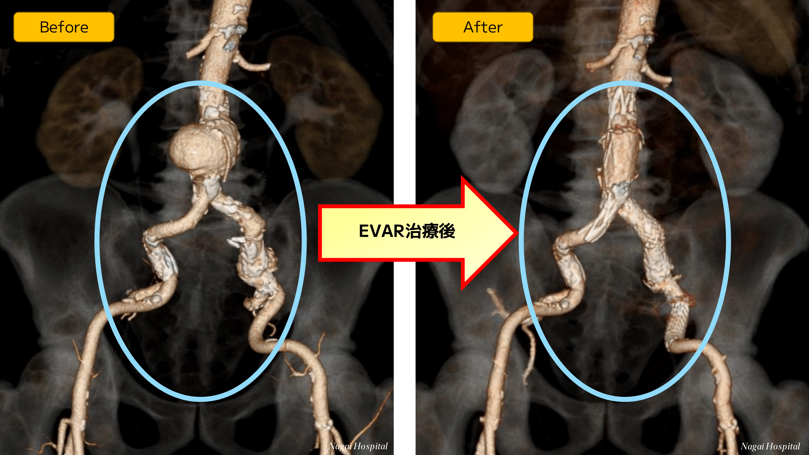 医療法人 永井病院|【臨床工学技士×診療放射線技師】 EVARでの